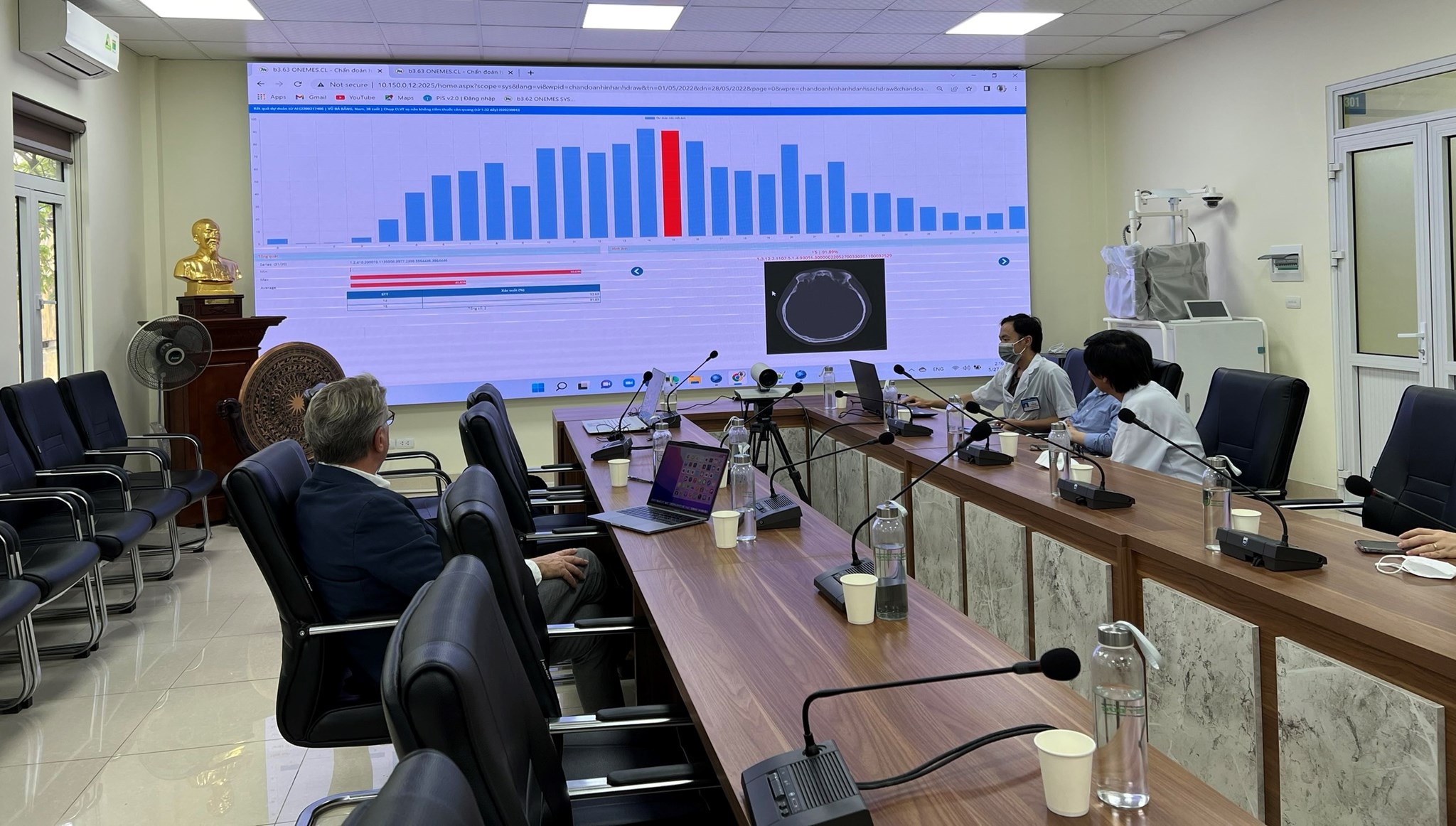 Hình ảnh tin tức ONENET phối hợp với chuyên gia Đức ứng dụng AI tại Bệnh viện Hữu nghị Việt Đức